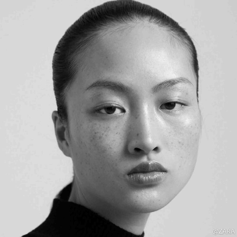 Read more about the article Outrage Over Zara Using Freckle-Faced Model In China