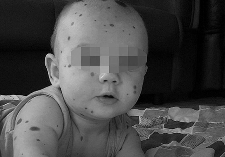 Read more about the article Cruel Priest Refuses To Baptise Cute Tot With Birthmark