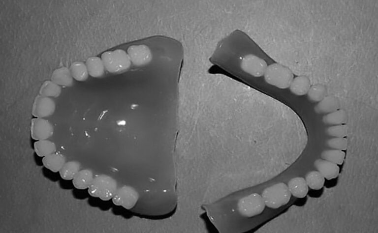 Read more about the article FB User Flogs Dead Granddads Dentures For 260 GBP
