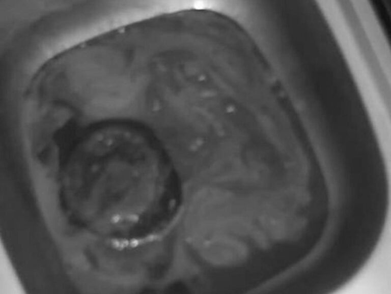 Read more about the article Pics Show Blood Poured Down Hospital Sink