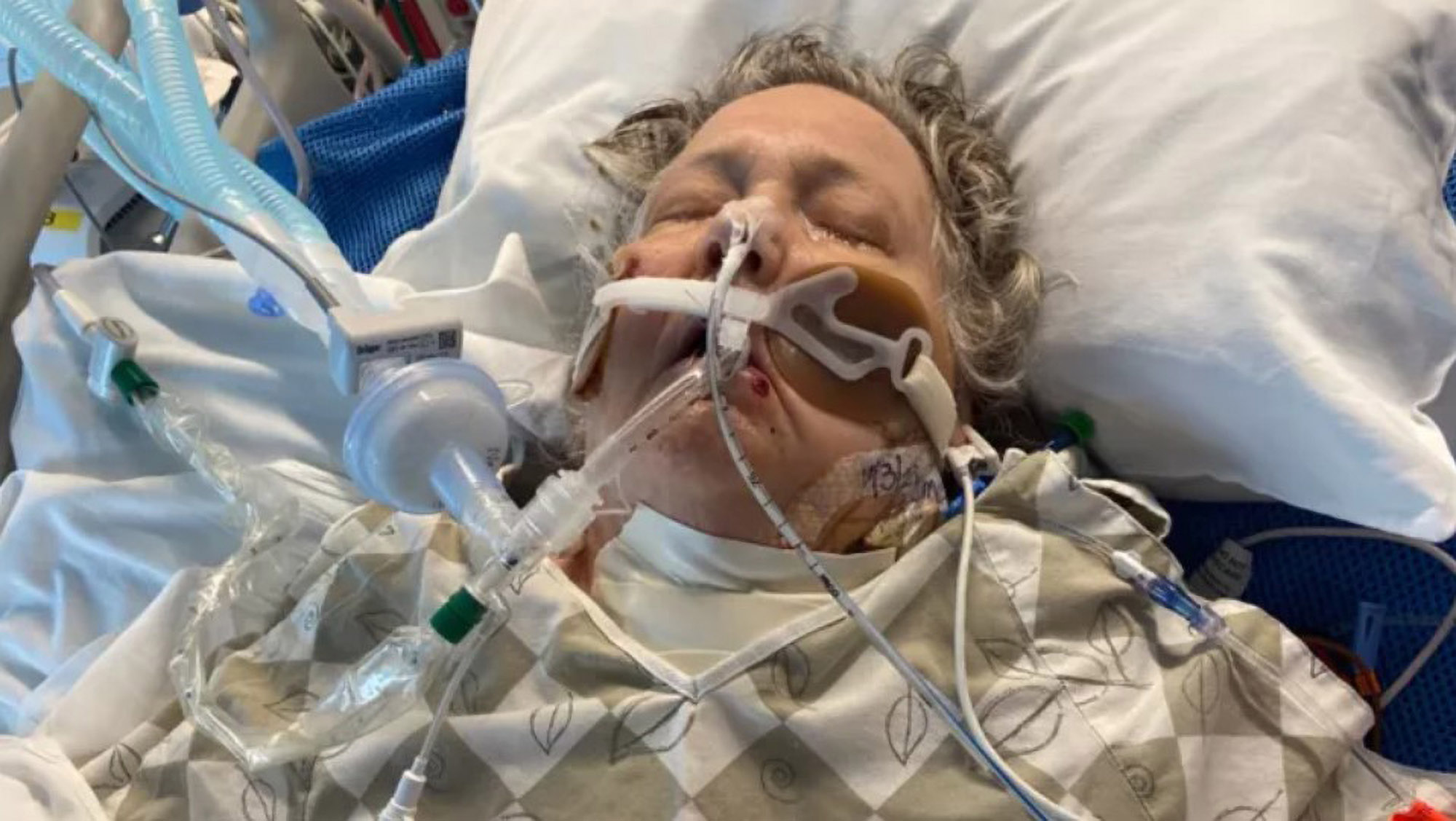 Read more about the article Coma Woman With COVID-19 Wakes Up Just As Her Life Support Machine Was Due To Be Switched Off