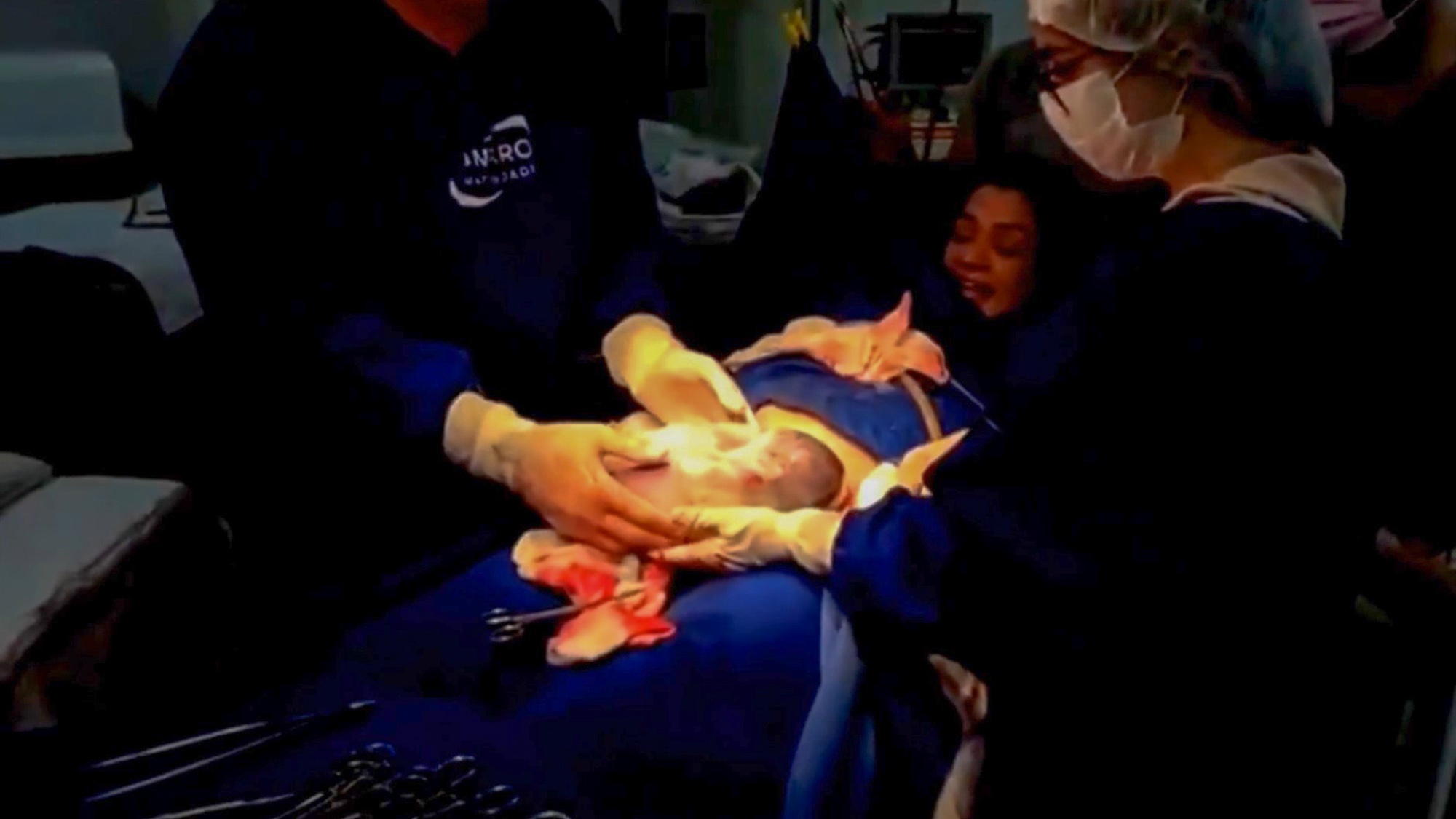 Read more about the article Incredible Moment Baby Breaks Own Amniotic Sac With Tiny Hand