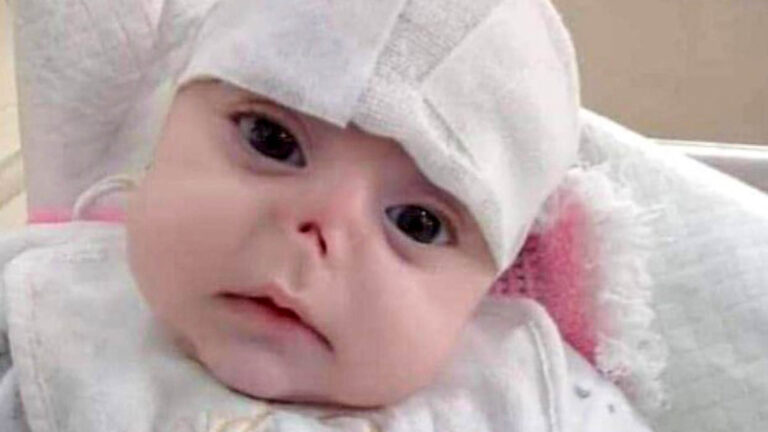 Read more about the article Shocking Images Show Baby With Nose Eaten By Rats After Being Abandoned On Aleppo Streets In War-Torn Syria