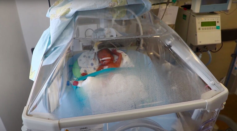Read more about the article Doctors Carry Out Rare Cutting Edge Umbilical Cord Stem Cell Transplant Surgery To Help Premature Baby Boy Grow Lungs