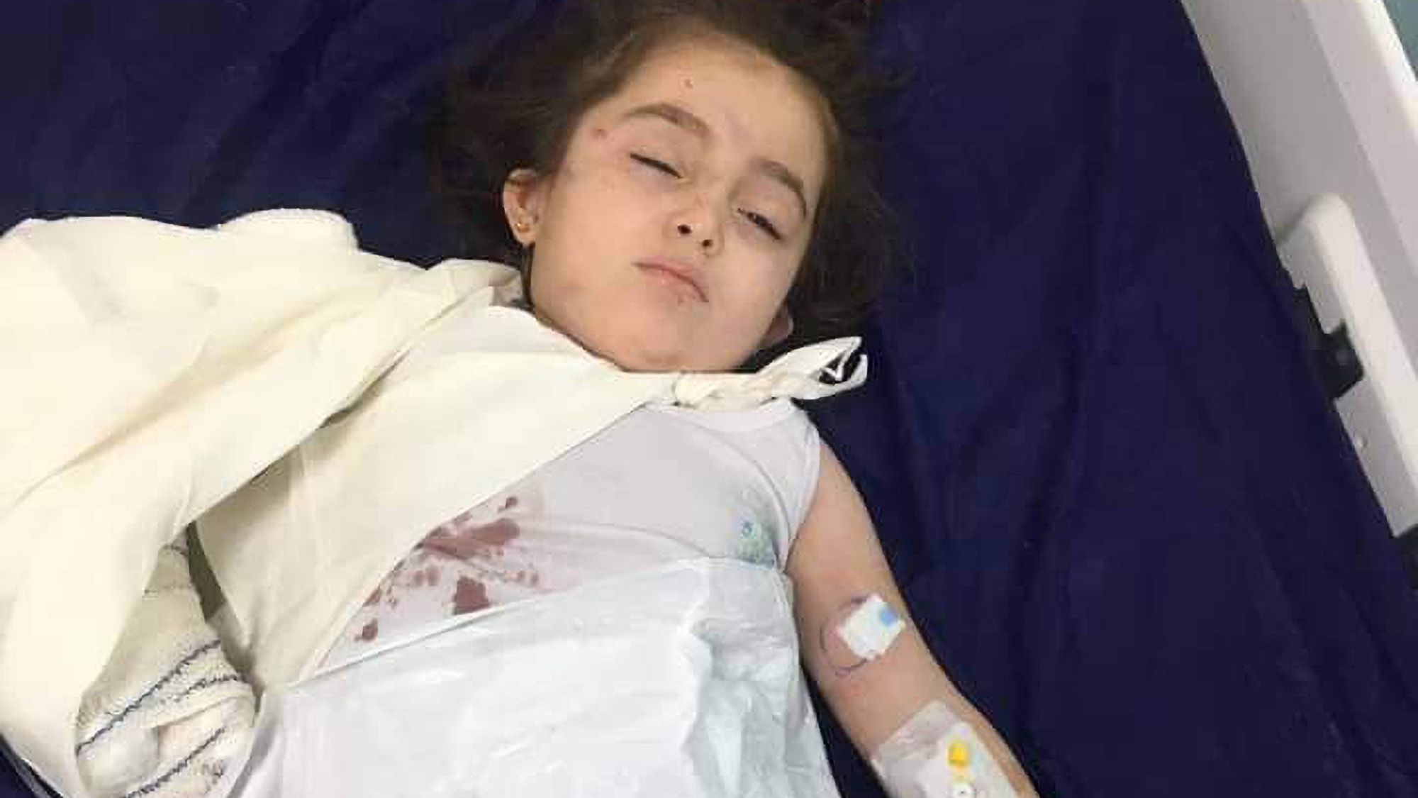 Read more about the article Zoo Bear Bites Off Three-Year Old Girl’s Arm
