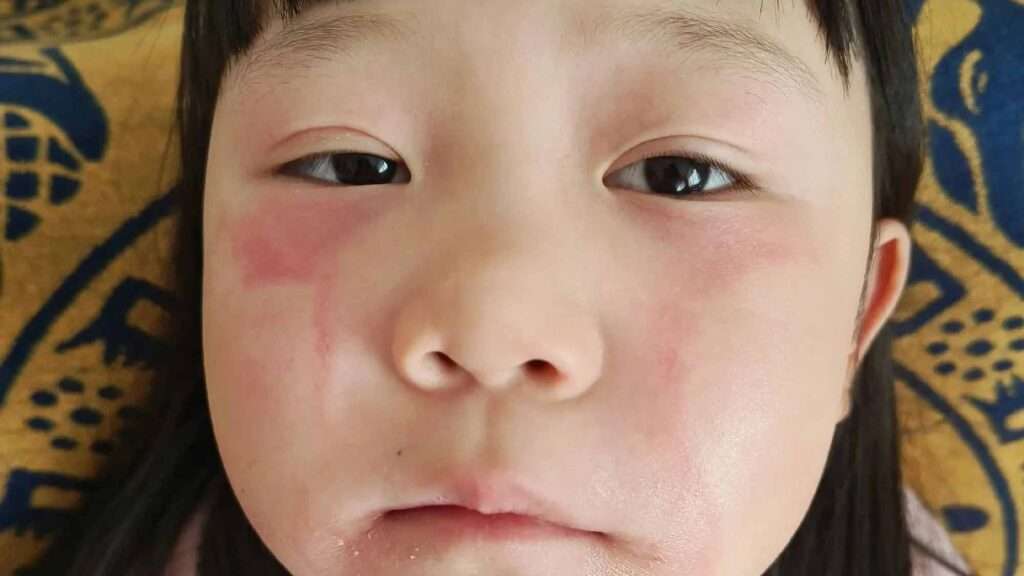 AsiaWire BabyAllergicTears 01 1024x576 