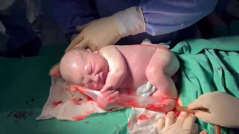 Read more about the article Newborn Still Asleep As He Emerges In Amniotic Sack