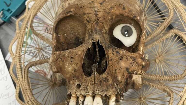 Read more about the article Human Skull With False Eye And Rotten Teeth Found In Charity Box