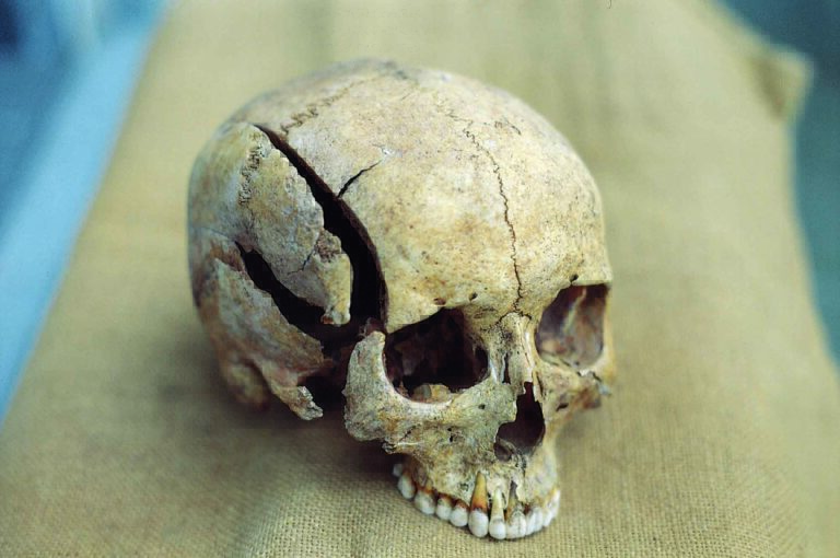 Read more about the article Cranial Injury Study Reveals Huge Violence In Lawless Ancient Middle-Eastern Cities